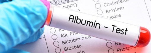 בדיקת רמות אלבומין בדם (Albumin) - תמונה